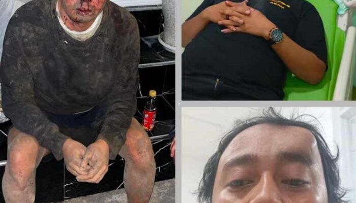 Polres Pasuruan Dikritik ‘Melempem’ Tangani Kasus Pengeroyokan BRN, Oknum Ormas Belum Jadi Tersangka