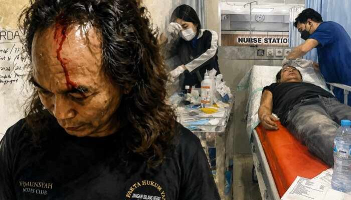 Advokat Asal Surabaya Dianiaya Saat Perayaan Ulang Tahunnya